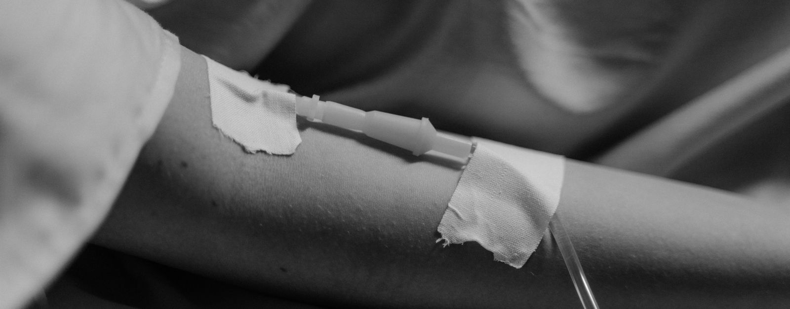 Close-up of a patient's forearm with a treatment line taped in place, resting on a blanket during a long session